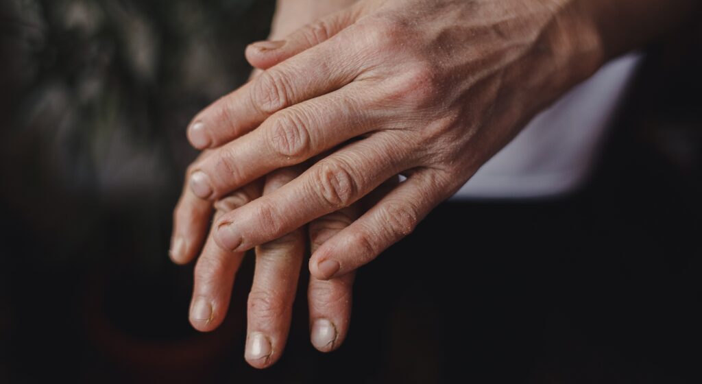 Mani secche e screpolate: come proteggerle dal freddo e dai lavaggi frequenti