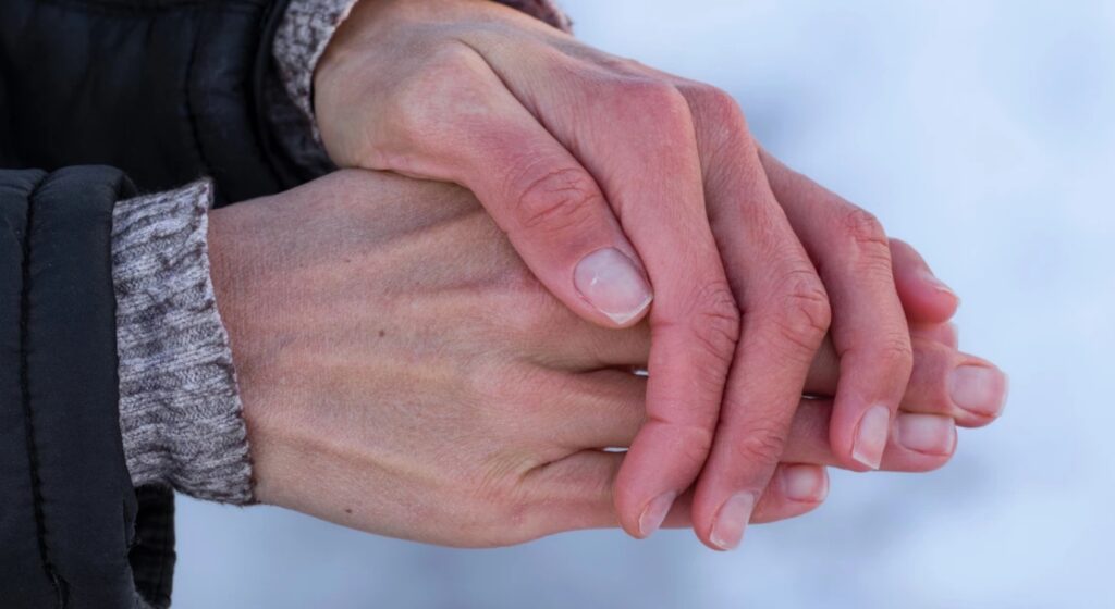 Dermatite da freddo: come riconoscerla e trattarla davvero in modo efficace