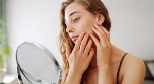 Pelle lucida e imperfezioni con i primi caldi: cosa succede e come riequilibrarla