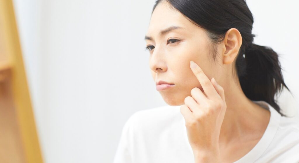 Pelle disidratata dal sole: come recuperare idratazione e luminosità Pelle disidratata dal sole: come recuperare idratazione e luminosità