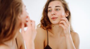Pelle secca dopo l’estate: come recuperare idratazione e comfort